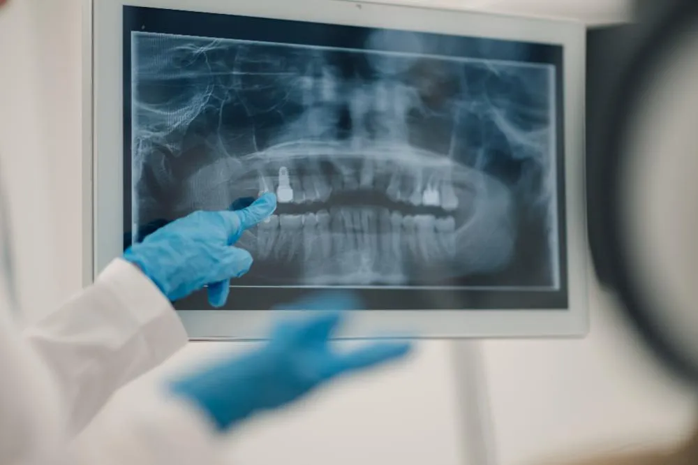 Dentist Pointing At Teeth X Ray On Computer Screen